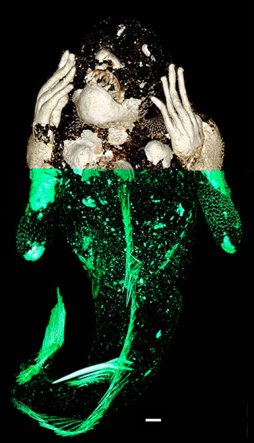 chụp x quang nàng tiên cá